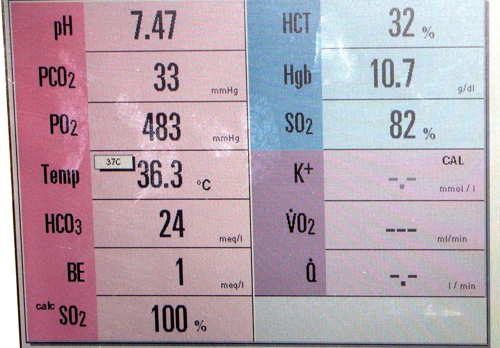 Monitoring a omezení recirkulace okysličené