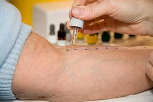 specifické IgE Diagnostika IgE mediované PA Anamnéza: