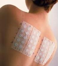 antigen specifické lymfocyty, eosinofily Diagnostika non-ige mediované PA Anamnéza: opožděné