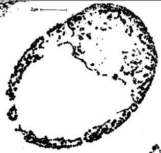 okraji chloroplastu.