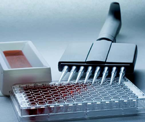 REFERENČNÍ LABORATOŘE NA SVÚ OLOMOUC Referenční laboratoř pro Aujeszkyho chorobu prasat Aujeszkyho choroba je virové onemocnění prasat a ostatních vnímavých zvířat (např.