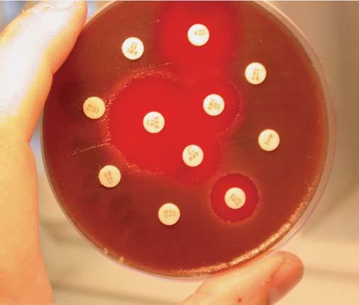 ODDĚLENÍ SPECIÁLNÍ MIKROBIOLOGIE ODDĚLENÍ SPECIÁLNÍ MIKROBIOLOGIE Infekční onemocnění představují významný problém i v 21.