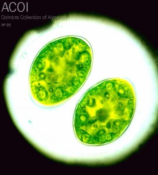 Oocystis