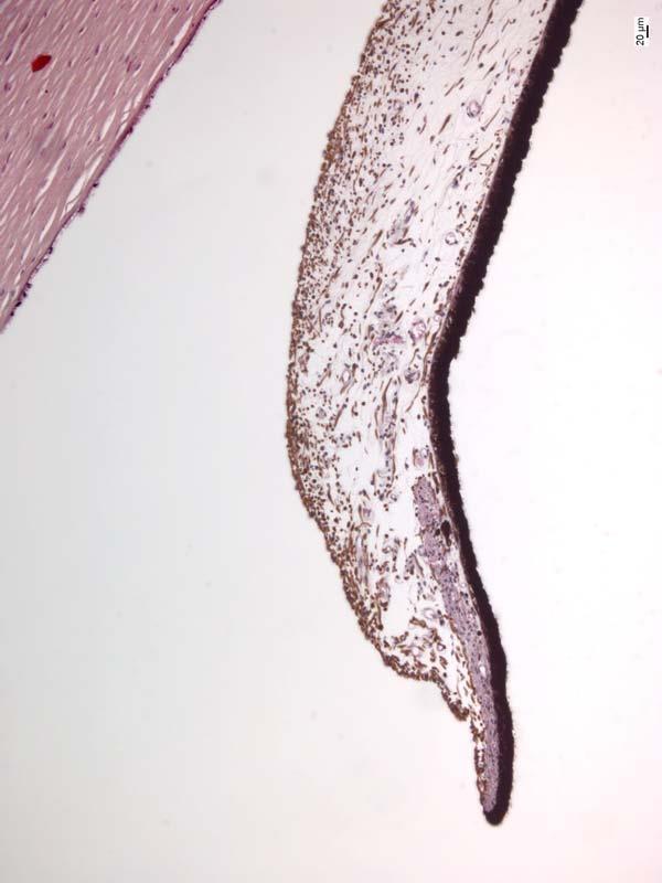 Duhovka (iris) Přední epitel - Nesouvislá vrstva Přední hraniční vrstva - Pigmentoé buňky