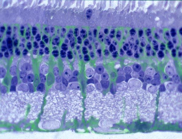 neurony Retina -