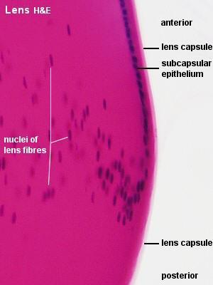 capsula lentis Čočka Tvoří ji buňky subkapsulárního epitelu