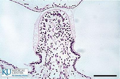 Ductus semicirculares crista ampullaris