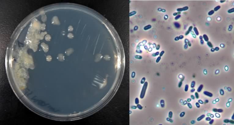 Clostridium difficile