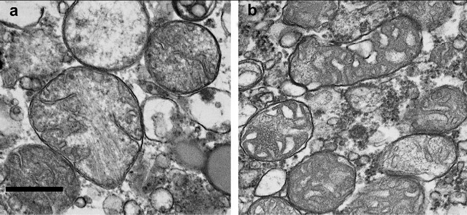 Vliv metabolické aktivity na morfologii mitochondrií Ortodoxní stav (zvětšený prostor matrix a málo krist; mitochondrie respiračně málo