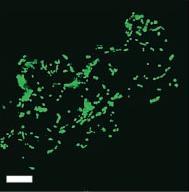 pomocí MD prstence Hlavní prokaryotní komponenty dělícího aparátu (FtsZ) se v mitochondriích WT mitochondrie Mitochondrie v buňkách vyšších eukaryot nedochovaly (Arabidopsis,