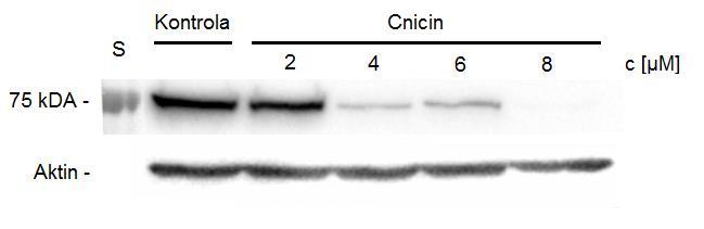 4.2.2. DDX3 Protein DDX3 je RNA helikasa, ovlivňující proliferaci, apoptosu a diferenciaci. Přesné mechanismy jeho funkce nejsou známy.