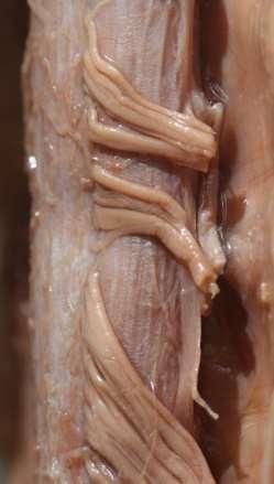 6-fasciculus gracilis B-pia mater s
