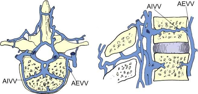Plexus venosi vertebrales plexus venosi vertebrales nemají chlopně (šíření zánětu a nádorů)a anastomosují mezi sebou anastamosují s žilními plexy kolem os sacrum a pánve jsou: 1)