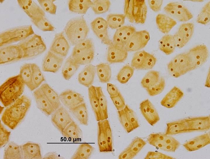 NOR-banding u cibule.