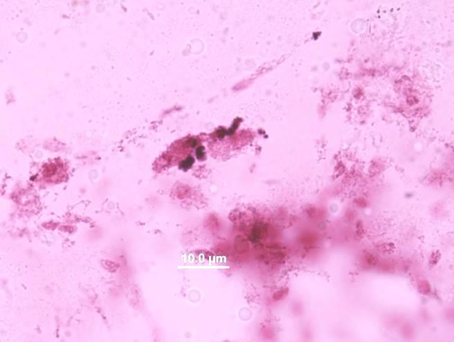 metafázní chromozómy Metafázní chromozómy v mozkových gangliích drozofily. Z: 1 000x (imerze). Úsečka 10 µm. Foto Pavla Válová. Pracovní postup: CVIČENÍ č.
