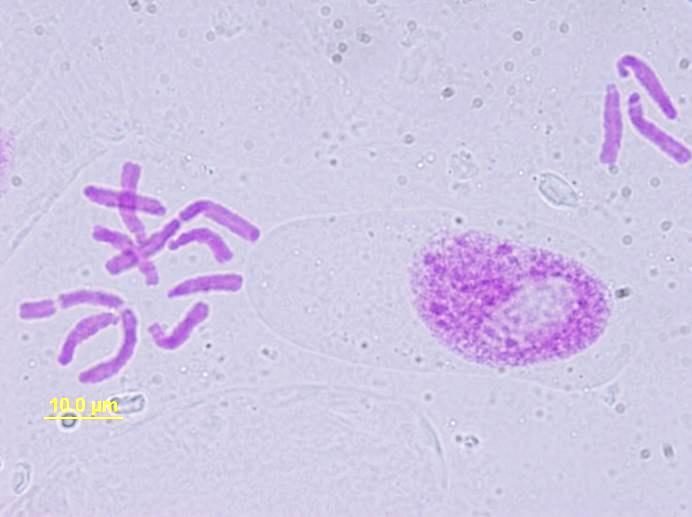 Bob koňský (Vicia faba L.). Z: 1000x, imerze.