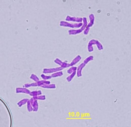 Cibule kuchyňská (Allium cepa L.). Z: 1 000x, imerze. Úsečka 10 µm. Foto Pavla Válová.