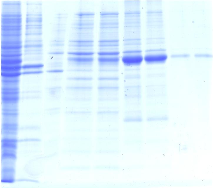 MH 1 2 3 4 5 6 7 8 9 66,2 45 35 25 18,4 Obr. 4.1.1.1: Purifikace prokatepsinu B z rozpuštěných inkluzí pomocí chromatografie na Ni NTA nosiči.