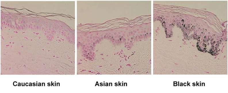 Obsah melaninu v kůži u rozdílných etnik Histologická detekce obsahu melaninu Obsah melaninu v