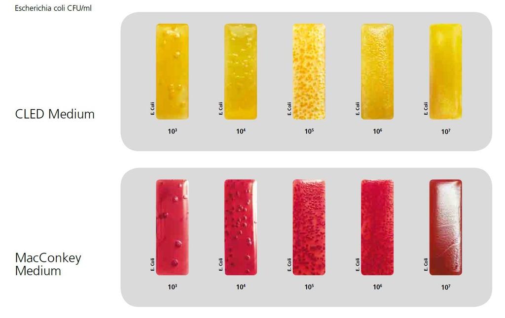 Uchovávání vzorku a transport do laboratoře Uchovávání: MOČ: maximálně 24 hod, při chladničkové teplotě URIKULT: maximálně 48 hod, při pokojové teplotě Transport: MOČ: v chlazeném přepravním boxu do