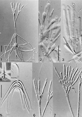 Trichomycetes trichospóry tvorba stolonu Trichomycetes se běžně vyskytují u herbivorních nebo detritivorních arthropod. Mohou se však vyskytovat i u predátorů.