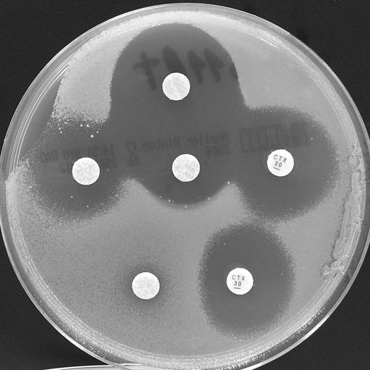 Kmen Escherichia coli dobře citlivý ke karbapenemům (MIC MER < 0,125 µg/ml) +OXA Kmen je producentem ESBL: Na +OXA je zřejmá deformace IZ směrem k disku s AMC (šipka označuje náznak hranice IZ).