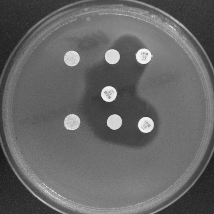 bývá stupeň rezistence takových kmenů velmi vysoký. Aztreonam je jediným antibiotikem, které v tomto případě může sloužit jako indikátor (tabulka 7).