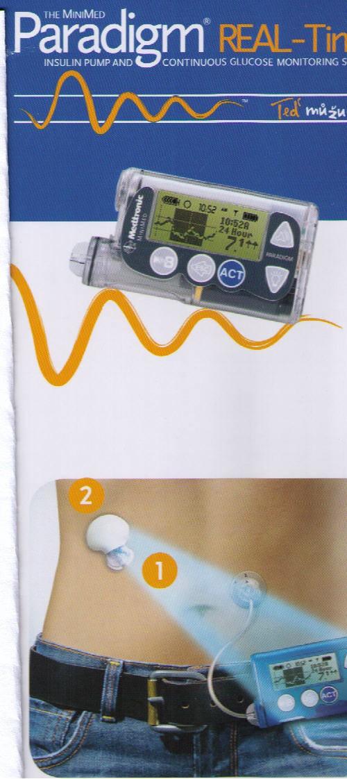 Selfmonitoring G a Ac v moči G v séru proužky - orientačně G