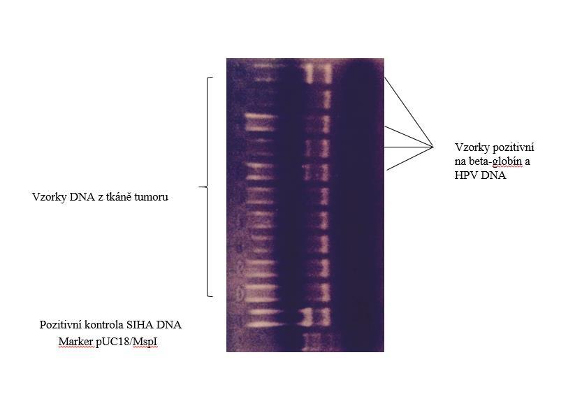 V cykleru PTC 200 firmy MJ Research, INC se amplifikovala DNA. Po dokončení bylo z každého vzorku 10 μl PCR produktu použito na elektroforézu v 3% agarozovém gelu (NuSieve 3:1, FMC BioProduct).