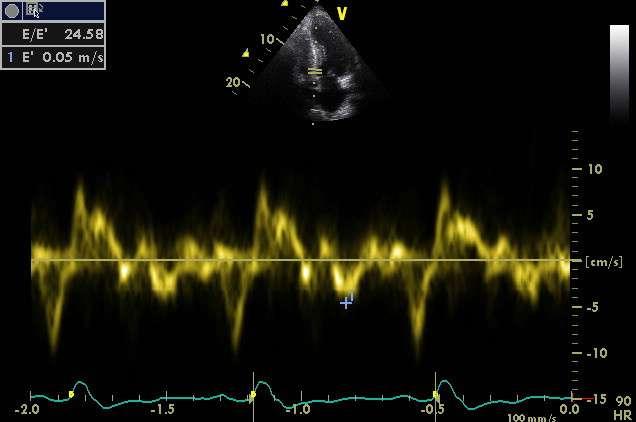 frequency signal with