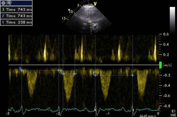 + 19) = 11s Applications in ischaemic heart disease DDD