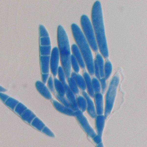 3.2.5 Významné toxiny rodu Fusarium Plísně rodu Fusarium jsou v přírodě hojně rozšířené především v půdě a kontaminují tak užitkové plodiny.