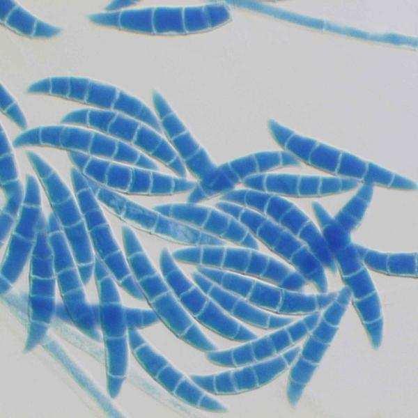 V klimatických podmínkách mírného pásma jsou nejrozšířenější právě mykotoxiny produkované vláknitými mikromycetami rodu Fusarium.