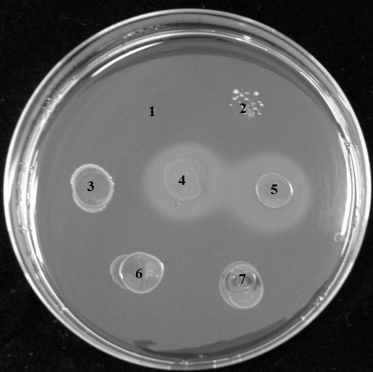 casei CCDM 198, L. acidophilus ATCC 4356TM, L. acidophilus ATCC 314 TM). L. acidophilus ATCC 4356TM byl použit jako srovnávací BSH pozitivní kmen a Escherichia coli CNCTC 6859 jako srovnávací BSH negativní kmen.