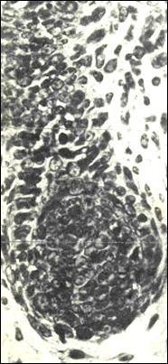 bulbární čep segmenty : bulbus s mitoticky aktivní matrix a mezodermální papila z matrix vzniká konus buněk, které později vytvářejí vlas istmus folikulu infundibulum embryonální výduť pro úpon m.