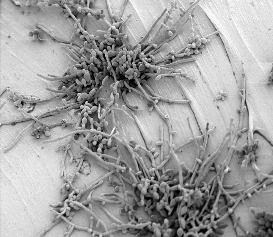 Biofilmy kvasinek rodu