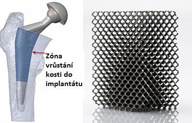 FSI VUT BAKALÁŘSKÁ PRÁCE List 20 2.1.3 Kyčelní implantát Kyčelní implantát se skládá z 3 částí; kyčelní stopky, kyčelní jamky a hlavice kyčelního kloubu.