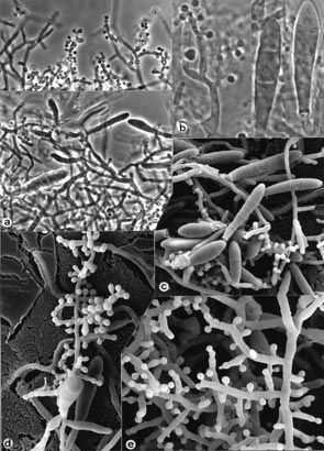 Trichophyton interdigitale makrokonidie většinou chybí mikrokonidie kapkovité v nesporulujících kulturách nodulární shluky buněk obklopené