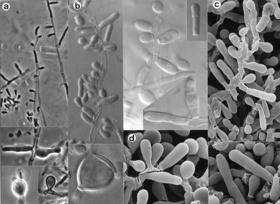 Trichophyton tonsurans makrokonidie pokud jsou přítomny, tenkostěnné, 2-6 buněčné, cylindrické až cigárovité mikrokonidie různé velikosti, válcovité, kulovité i hruškovité,