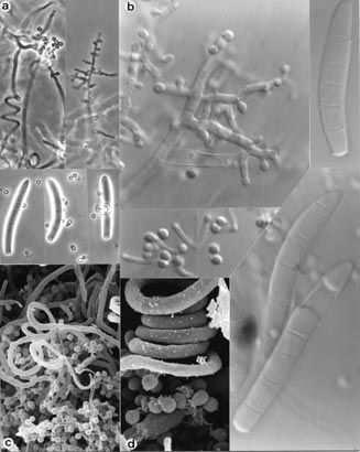 Trichophyton mentagrophytes makrokonidie, hladké, tenkostěnné, 3-8 buněčné,