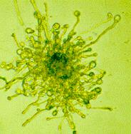 terminální ztluštění vezikuly (4 5 den kultivace) http://www.mycology.adelaide.edu.