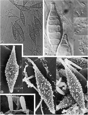 Microsporum canis makrokonidie bradavčité, silnostěnné, vřetenovité, na obou koncích zašpičatělé, 6-12 buněčné, 35-110 x 12-25 µm