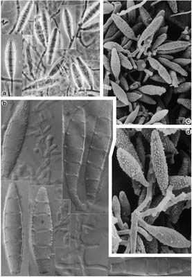 Microsporum gypseum geofilní infekce lidí (zejména intenzivně pracující s půdou) i zvířat původce tinea corporis nebo tinea capitis rychle rostoucí kolonie okrové s nádechem skořicové, okraj