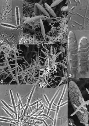 au/fungal_descriptions/dermatophytes/microsporum/microsporum_fulvum.