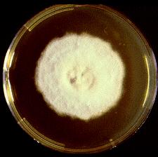 Microsporum audouinii antropofilní původce tinea capitis nalézán zejména u dětí endemické oblasti v Africe,