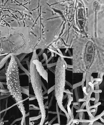 nepravidelně vřetenovité mikrokonidie vzácné http://www.mycology.adelaide.edu.