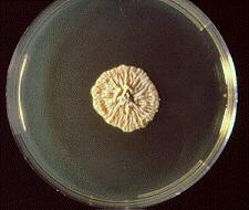 Microsporum ferrugineum antropofilní původce tinea capitis u dětí pomalu rostoucí endemické oblasti v