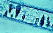 Diagnostika dermatofytóz Vlasový perforační test některé druhy mají schopnost perforovat vlas in vitro části mycelia jsou inkubovány ve 25 ml vody obsahující 2-3 kapky kvasničního extraktu a