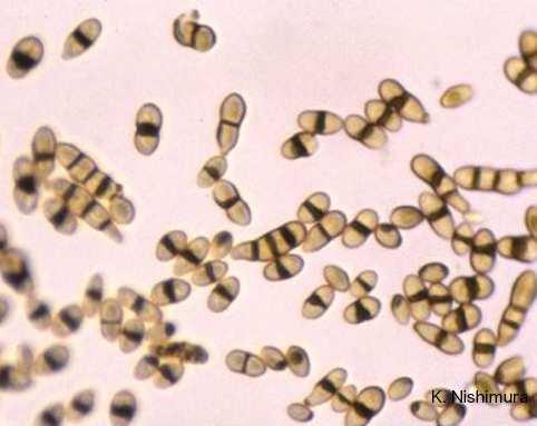 pučící, přechází ve shluky chlamydospor kolonie hladké, slizovité, olivově černé PDA http://www.pf.chiba-u.ac.
