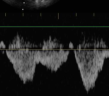 z obou přístupů jsou srovnatelné (Harabor 2012) Hodnoty jsou ovlivněny respirací Průtok